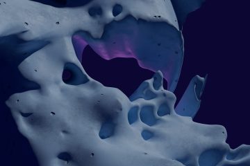 person experiencing jaw clicking, jaw tension, and TMJ symptoms in Ottawa