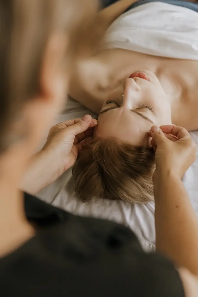 Tracey Crocker Acupuncturist Triada Health Ottawa during a facial acupuncture treatment 